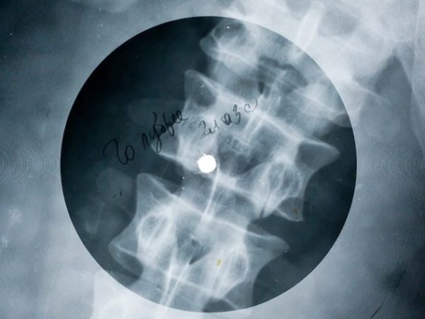 Musical X-Rays: A Story of Improvisation and Rebellion