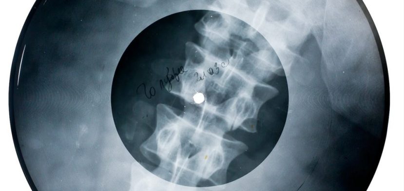 Musical X-Rays: A Story of Improvisation and Rebellion
